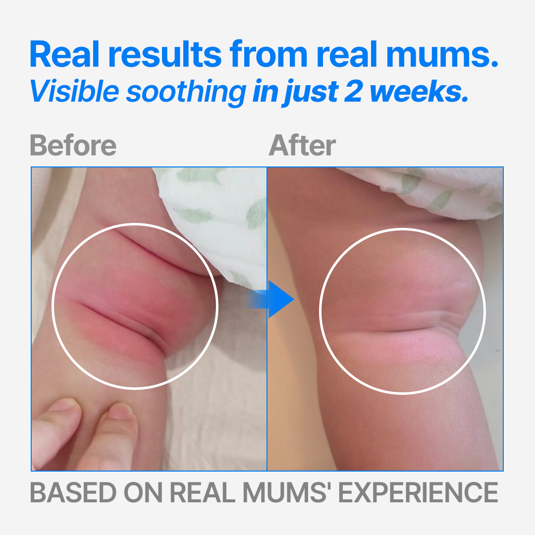 Lesstopy ATO Cream for Infants, Organic Sensitive Skin Moisturizer